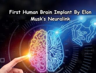 First Human Brain Implant By Elon Musks Neuralink